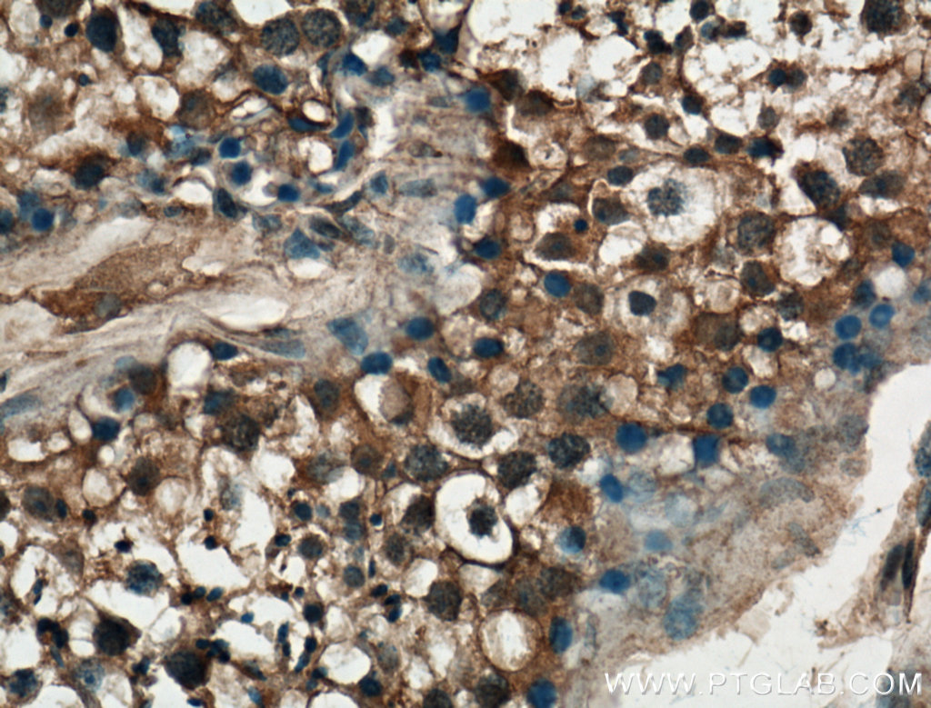 IHC staining of human testis using 26691-1-AP