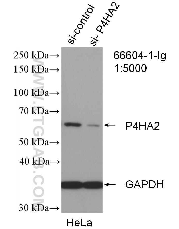 WB analysis of HeLa using 66604-1-Ig (same clone as 66604-1-PBS)