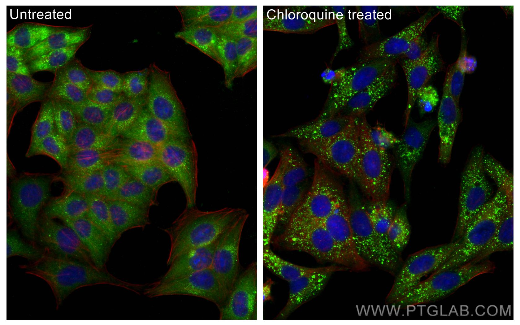 IF Staining of HepG2 using 31403-1-AP