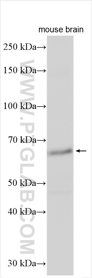 WB analysis using 31403-1-AP