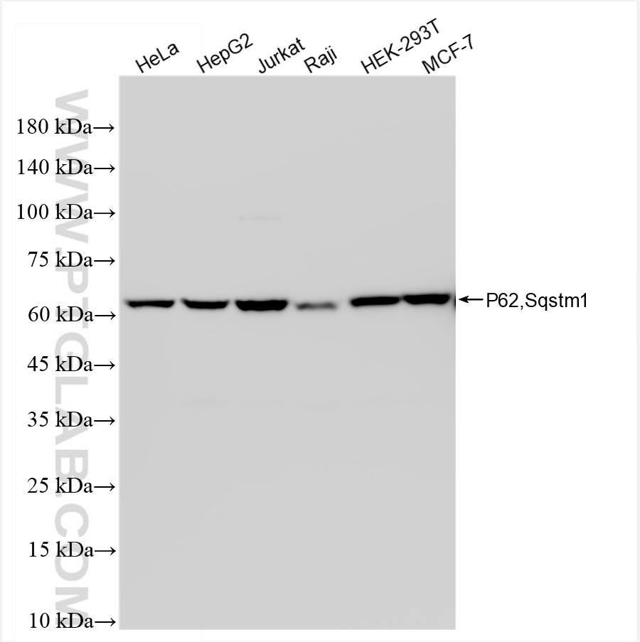 WB analysis using 84826-1-RR