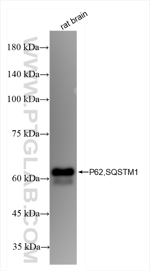 WB analysis of rat brain using 84826-1-RR (same clone as 84826-1-PBS)