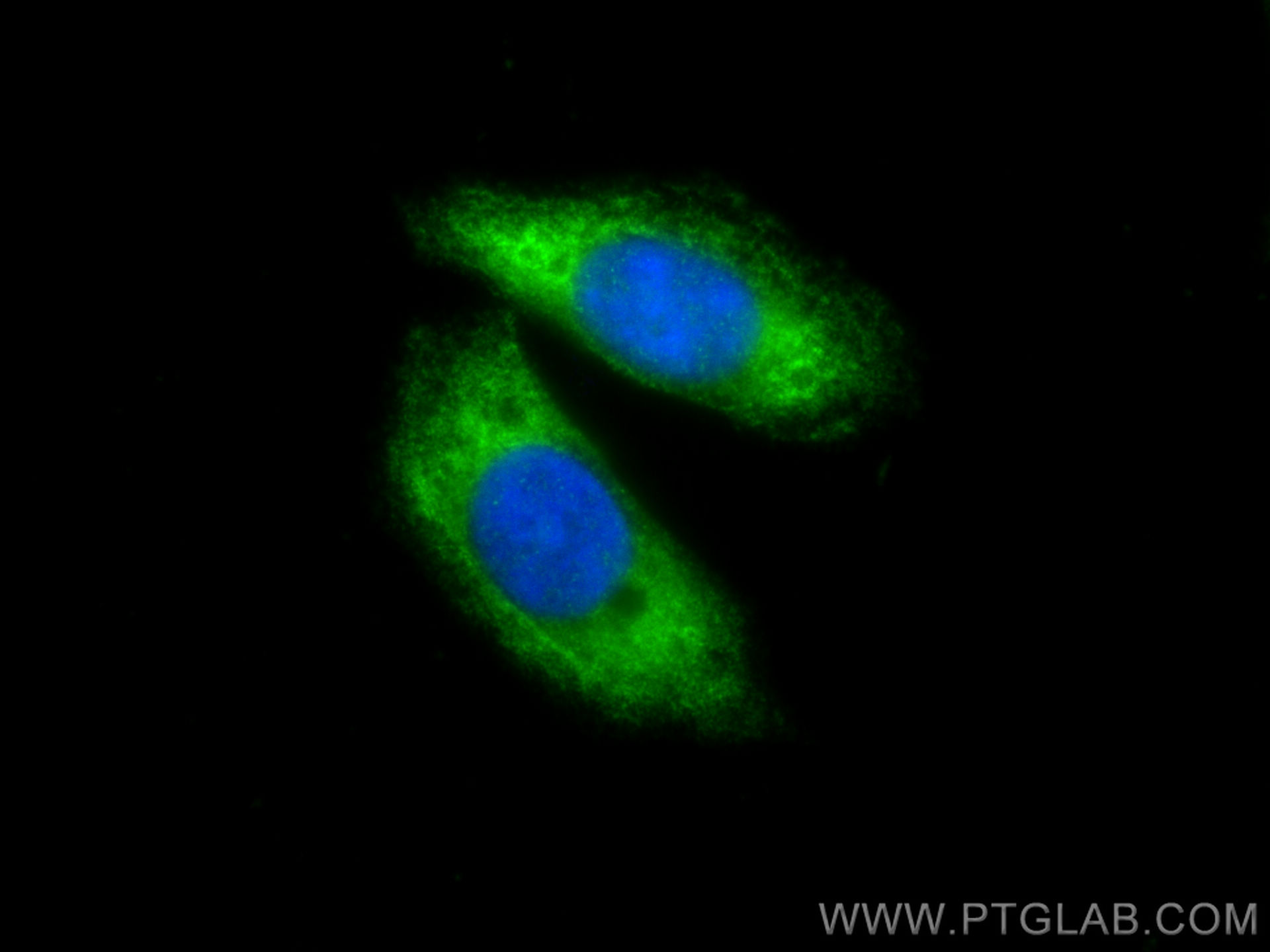 IF Staining of HepG2 using 15348-1-AP