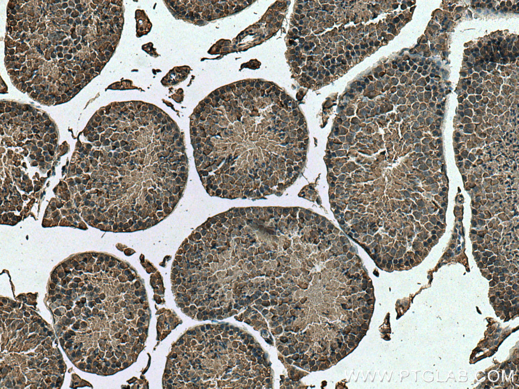 IHC staining of mouse testis using 66809-1-Ig (same clone as 66809-1-PBS)