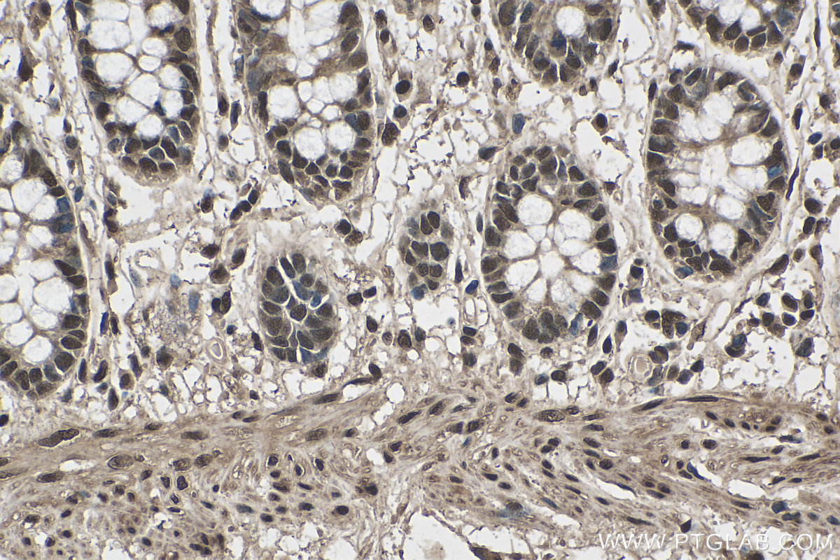 IHC staining of human colon using 66807-1-Ig