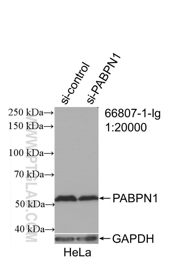 WB analysis of HeLa using 66807-1-Ig