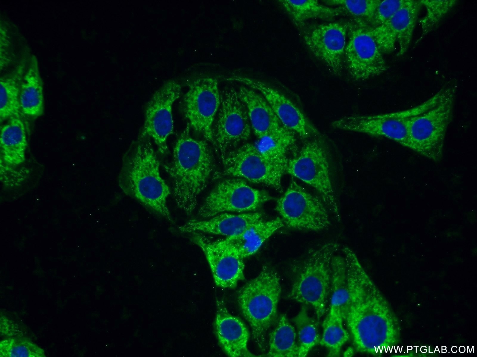 IF Staining of SH-SY5Y using 13219-1-AP