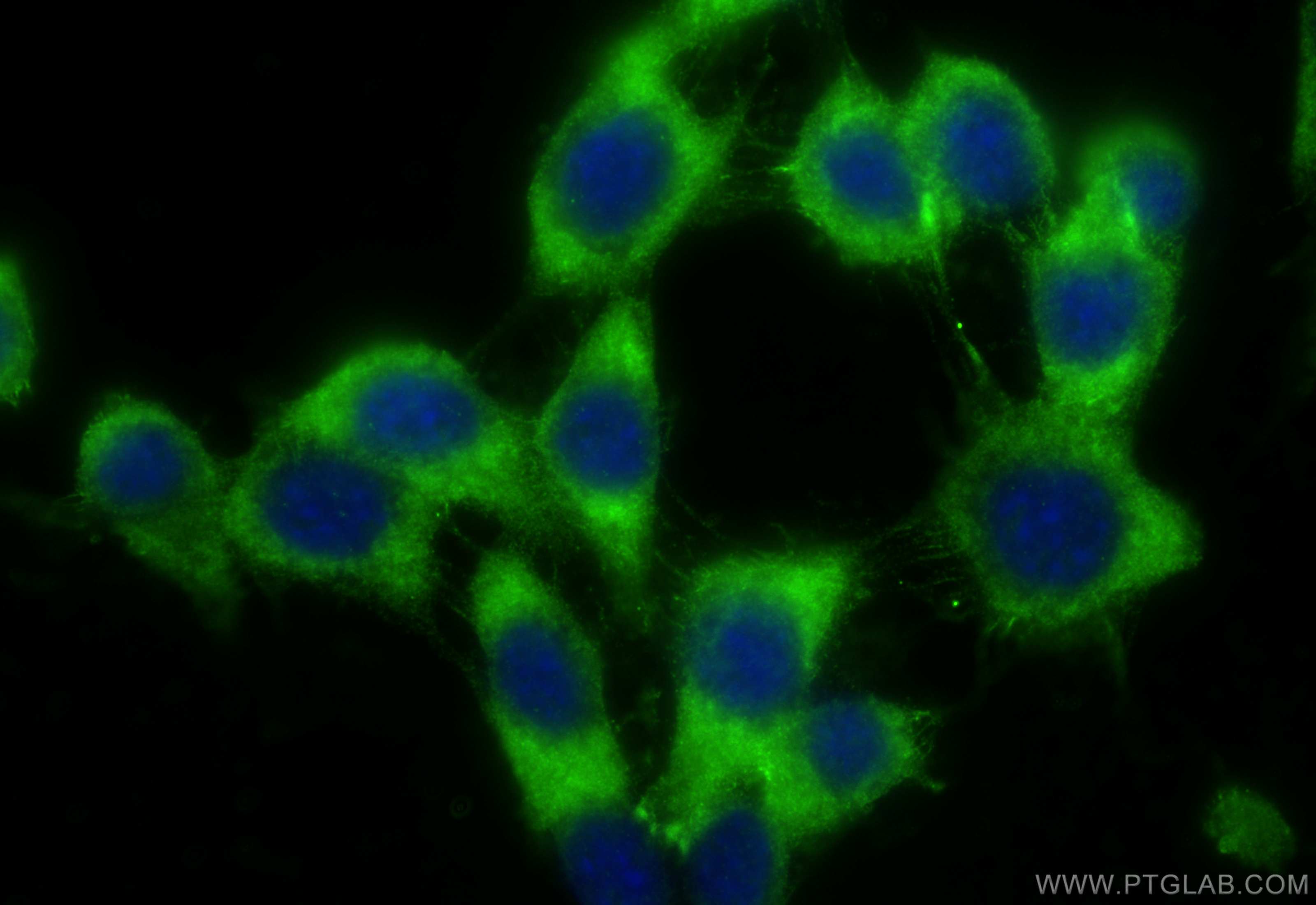 IF Staining of NIH/3T3 using 10518-2-AP