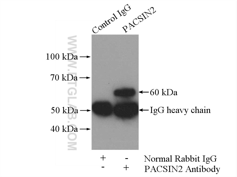 IP experiment of NIH/3T3 using 10518-2-AP