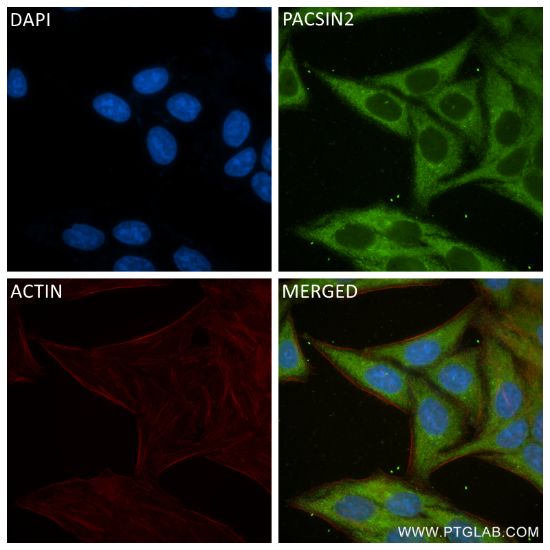 IF Staining of HepG2 using 84763-4-RR