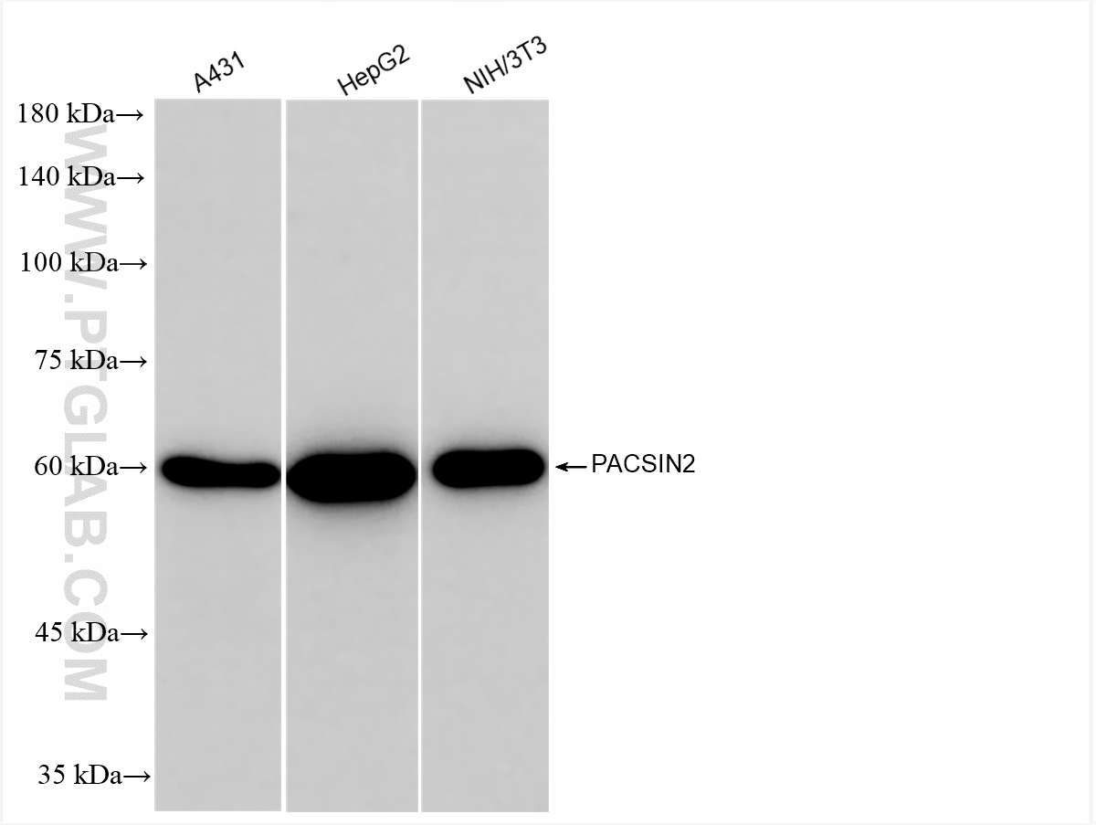 WB analysis using 84763-4-RR