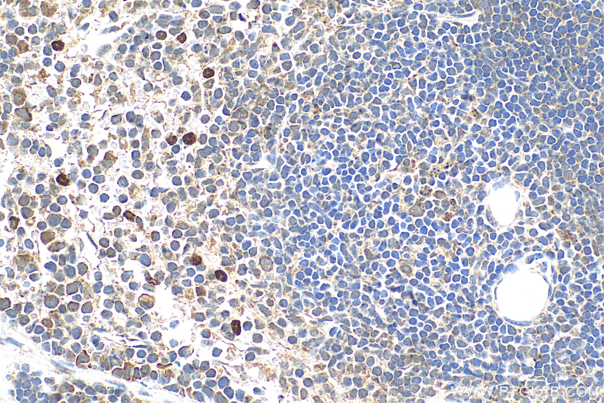 IHC staining of mouse spleen using 17373-1-AP