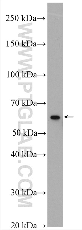 WB analysis of mouse spleen using 17373-1-AP