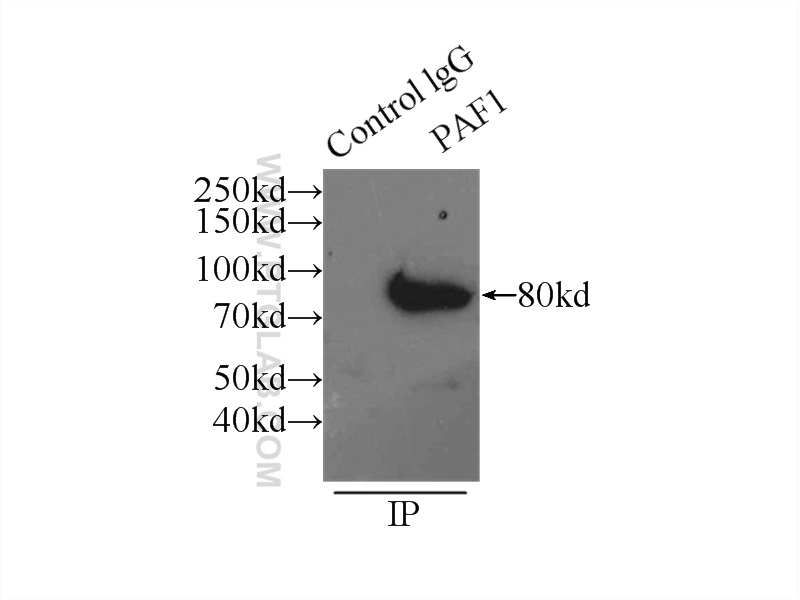 IP experiment of HeLa using 15441-1-AP