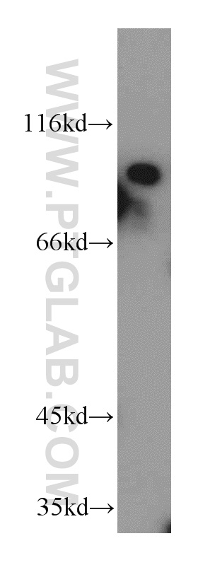 WB analysis of HepG2 using 15441-1-AP