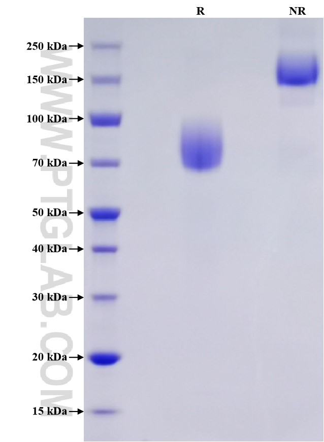 Recombinant Human B7-2/CD86 Protein (hFc Tag, Myc Tag, His Tag ...