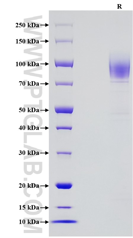 Purity of Recombinant Human PDGFR beta was determined by SDS-PAGE. The protein was resolved in an SDS-PAGE in reducing (R) conditions and stained using Coomassie blue.