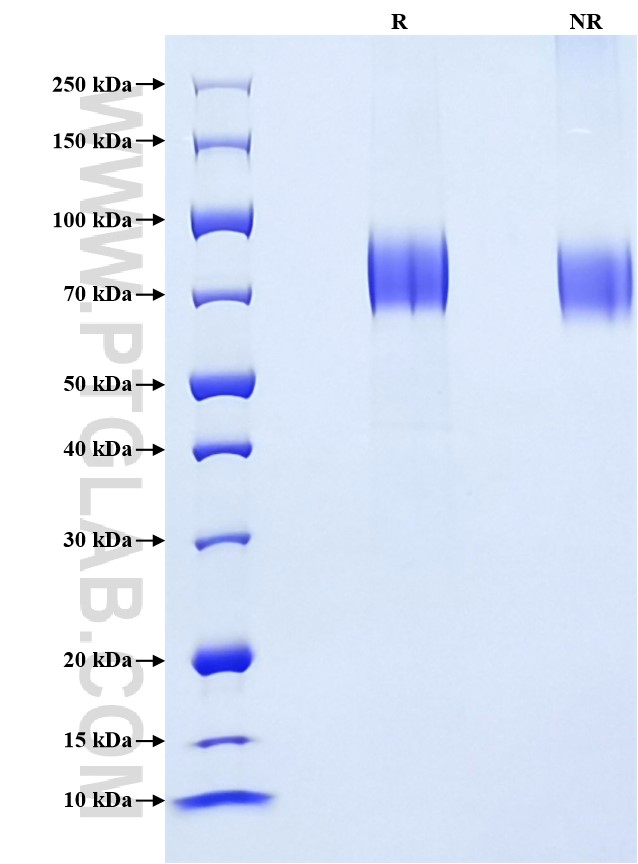 Purity of Recombinant Human Interferon alpha/beta receptor 1 was determined by SDS-PAGE. The protein was resolved in an SDS-PAGE in reducing (R) and non-reducing (NR) conditions and stained using Coomassie blue.