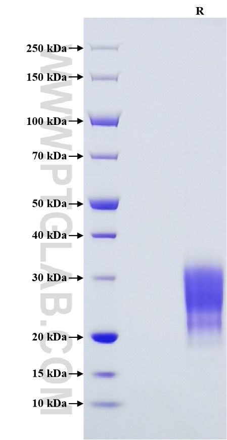 Purity of Recombinant Rat IFN-gamma was determined by SDS-PAGE. The protein was resolved in an SDS-PAGE in reducing (R) conditions and stained using Coomassie blue.