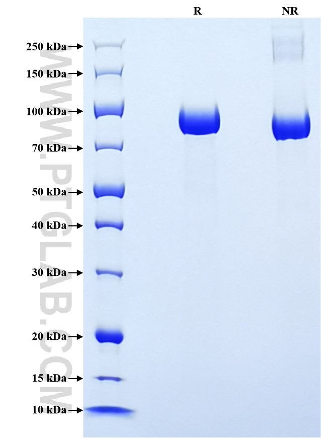 Purity of Recombinant Rat MMP9 was determined by SDS-PAGE. The protein was resolved in an SDS-PAGE in reducing (R) and non-reducing (NR) conditions and stained using Coomassie blue.