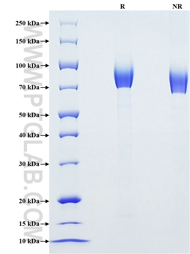 Purity of Recombinant Mouse ICAM-1 was determined by SDS-PAGE. The protein was resolved in an SDS-PAGE in reducing (R) and non-reducing (NR) conditions and stained using Coomassie blue.