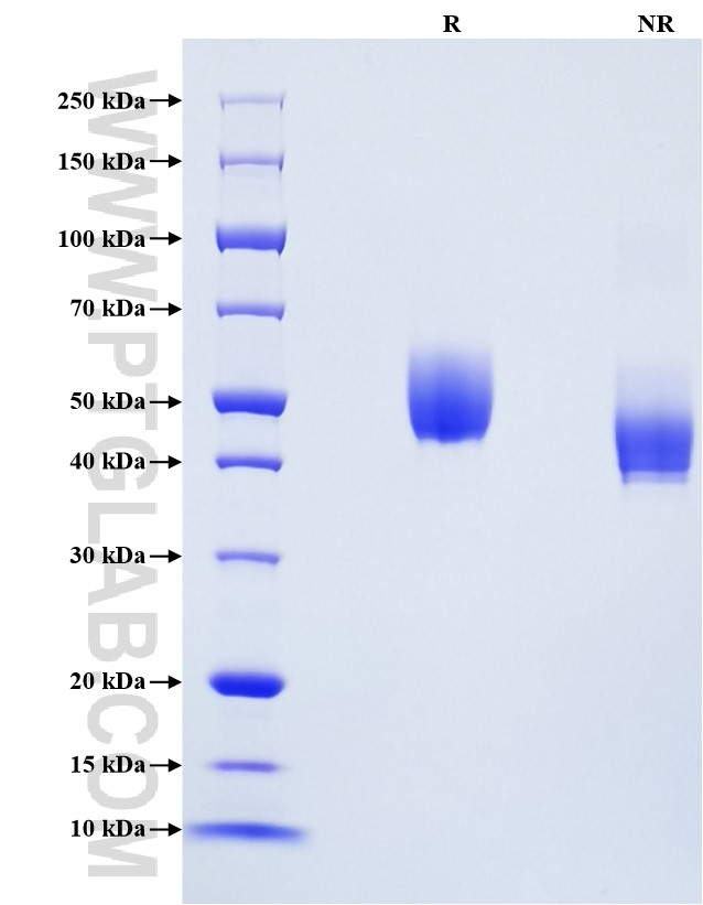 Purity of Recombinant Human CD14 was determined by SDS-PAGE. The protein was resolved in an SDS-PAGE in reducing (R) and non-reducing (NR) conditions and stained using Coomassie blue.