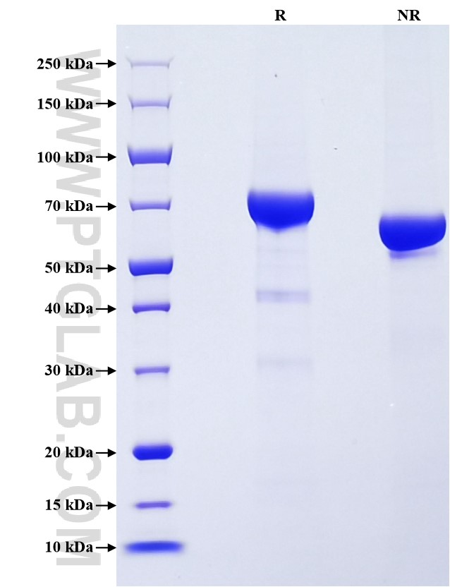 Purity of Recombinant Human AFP/Alpha-fetoprotein was determined by SDS-PAGE. The protein was resolved in an SDS-PAGE in reducing (R) and non-reducing (NR) conditions and stained using Coomassie blue.