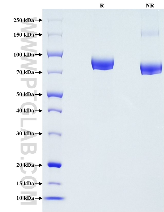 Purity of Recombinant Mouse VCAM-1 was determined by SDS-PAGE. The protein was resolved in an SDS-PAGE in reducing (R) and non-reducing (NR) conditions and stained using Coomassie blue.