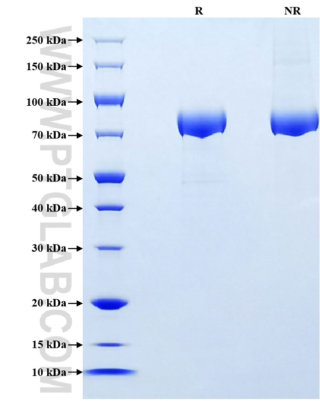 Purity of Recombinant Human N-Cadherin was determined by SDS-PAGE. The protein was resolved in an SDS-PAGE in reducing (R) and non-reducing (NR) conditions and stained using Coomassie blue.