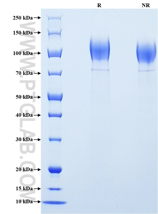 Purity of Recombinant Mouse CD45/PTPRC was determined by SDS-PAGE. The protein was resolved in an SDS-PAGE in reducing (R) and non-reducing (NR) conditions and stained using Coomassie blue.