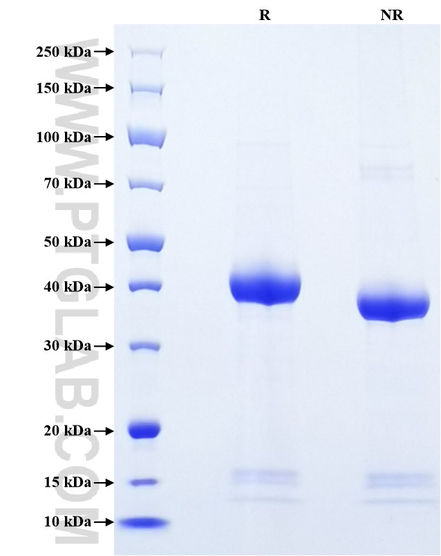 Purity of Recombinant Mouse RAGE was determined by SDS-PAGE. The protein was resolved in an SDS-PAGE in reducing (R) and non-reducing (NR) conditions and stained using Coomassie blue.