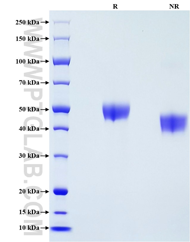 Purity of Recombinant Mouse CD5 was determined by SDS-PAGE. The protein was resolved in an SDS-PAGE in reducing (R) and non-reducing (NR) conditions and stained using Coomassie blue.