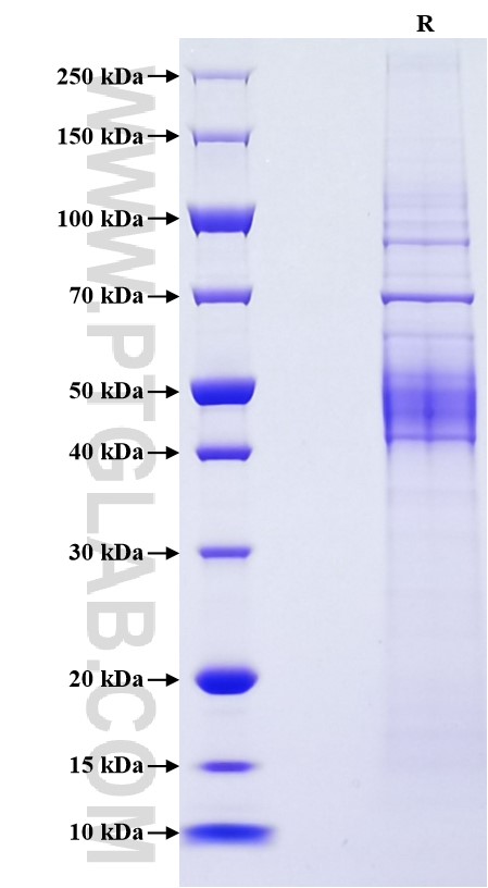 Purity of Recombinant Mouse CD19 was determined by SDS-PAGE. The protein was resolved in an SDS-PAGE in reducing (R) conditions and stained using Coomassie blue.