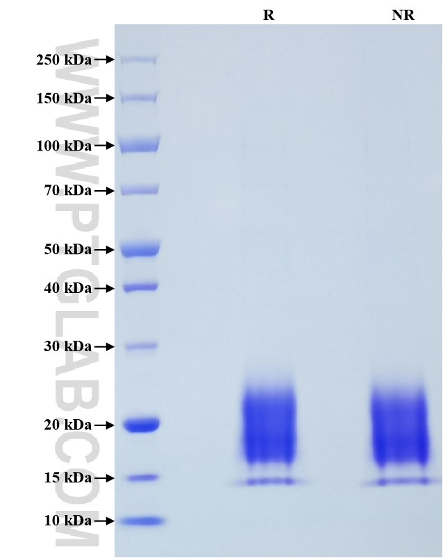 Purity of Recombinant Mouse TIGIT was determined by SDS-PAGE. The protein was resolved in an SDS-PAGE in reducing (R) and non-reducing (NR) conditions and stained using Coomassie blue.