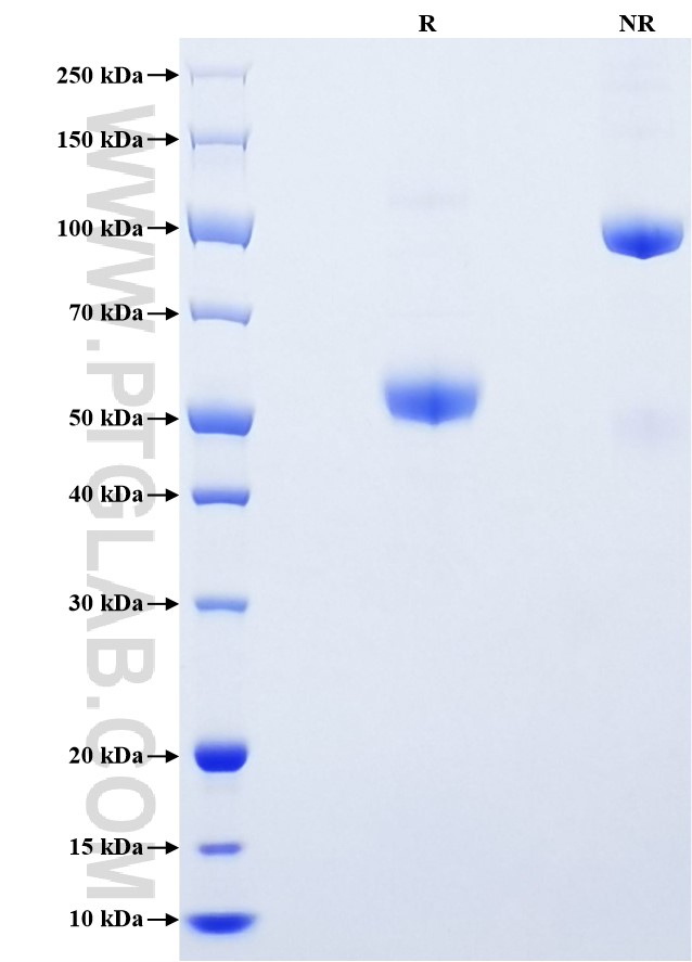 Purity of Recombinant Human IGFBP-1 was determined by SDS-PAGE. The protein was resolved in an SDS-PAGE in reducing (R) and non-reducing (NR) conditions and stained using Coomassie blue.