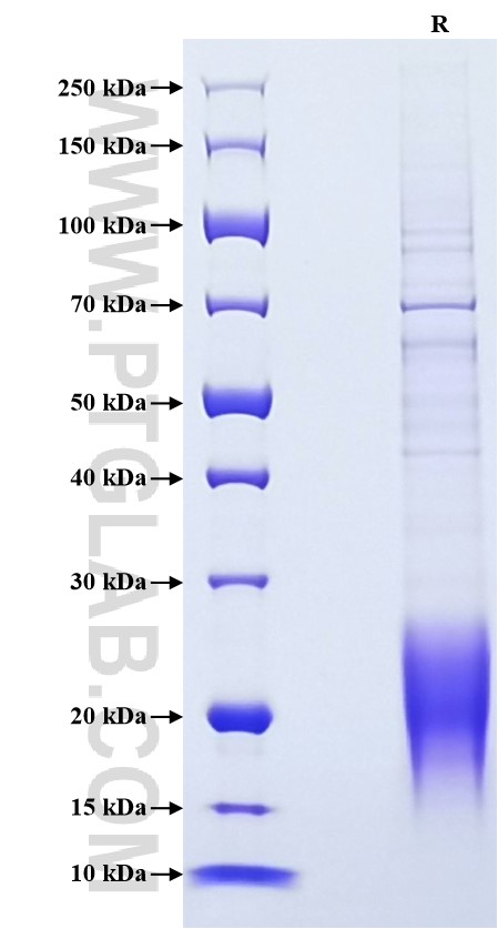 Purity of Recombinant Human Natriuretic peptides B was determined by SDS-PAGE. The protein was resolved in an SDS-PAGE in reducing (R) condition and stained using Coomassie blue.