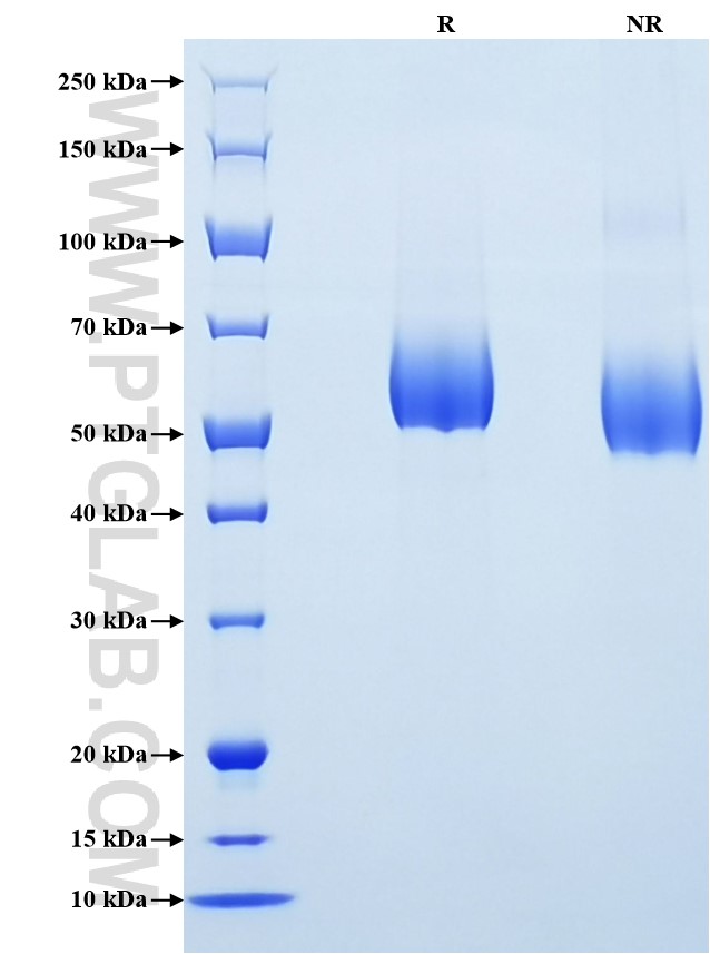 Purity of Recombinant Human FGFR3(IIIc) was determined by SDS-PAGE. The protein was resolved in an SDS-PAGE in reducing (R) and non-reducing (NR) conditions and stained using Coomassie blue.