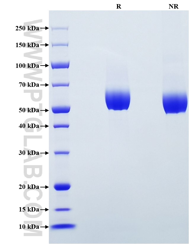 Purity of Recombinant Human FGFR3(IIIb) was determined by SDS-PAGE. The protein was resolved in an SDS-PAGE in reducing (R) and non-reducing (NR) conditions and stained using Coomassie blue.