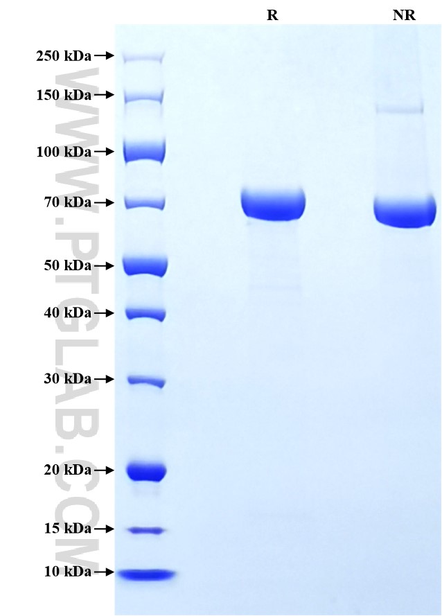 Purity of Recombinant Human E-cadherin was determined by SDS-PAGE. The protein was resolved in an SDS-PAGE in reducing (R) and non-reducing (NR) conditions and stained using Coomassie blue.