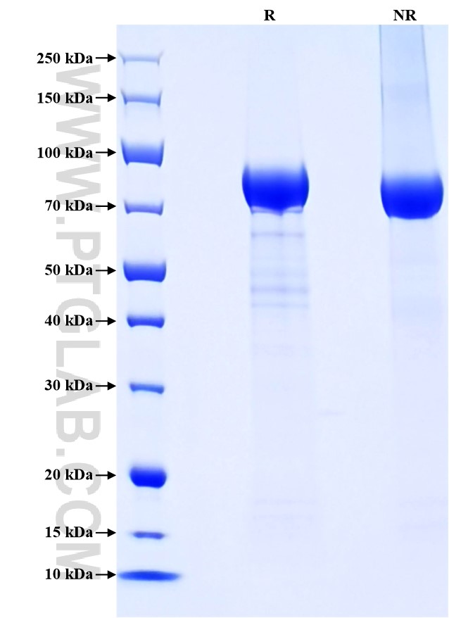 Purity of Recombinant Human VE-cadherin was determined by SDS-PAGE. The protein was resolved in an SDS-PAGE in reducing (R) and non-reducing (NR) conditions and stained using Coomassie blue.