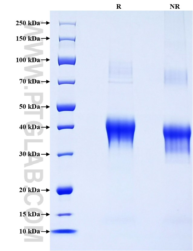 Purity of Recombinant Mouse CD23 was determined by SDS-PAGE. The protein was resolved in an SDS-PAGE in reducing (R) and non-reducing (NR) conditions and stained using Coomassie blue.