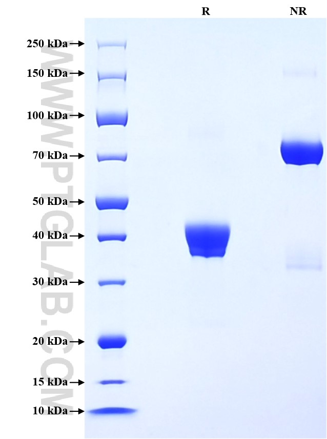 Purity of Recombinant Mouse CD9 was determined by SDS-PAGE. The protein was resolved in an SDS-PAGE in reducing (R) and non-reducing (NR) conditions and stained using Coomassie blue.