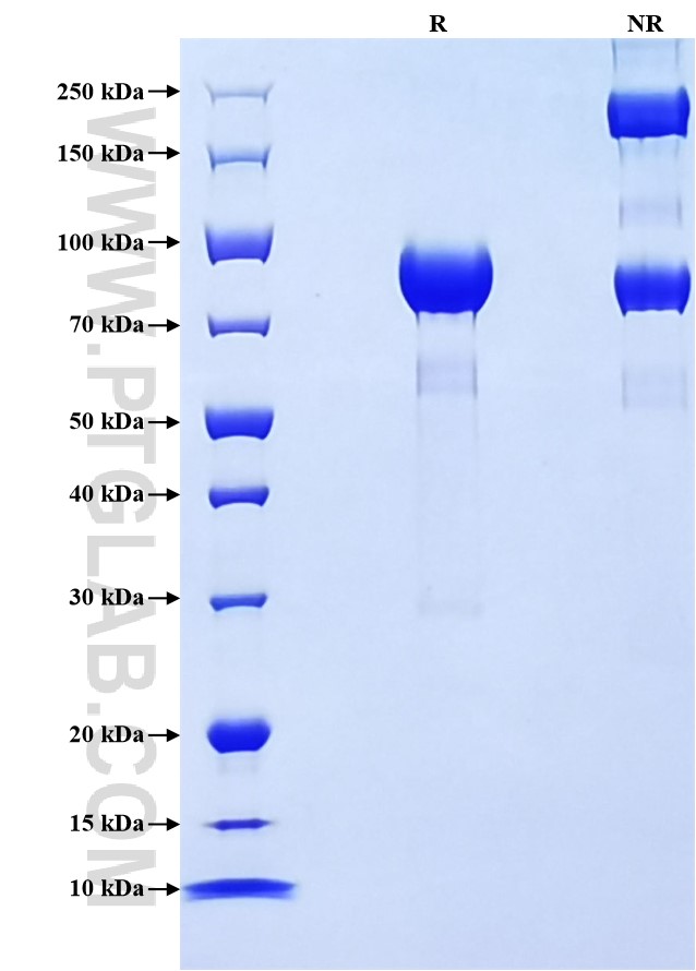 Purity of Recombinant Human CSF2RB was determined by SDS-PAGE. The protein was resolved in an SDS-PAGE in reducing (R) and non-reducing (NR) conditions and stained using Coomassie blue.