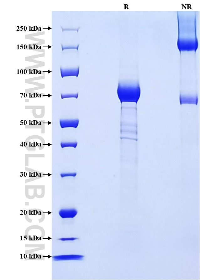 Purity of Recombinant Human IL-5RA was determined by SDS-PAGE. The protein was resolved in an SDS-PAGE in reducing (R) and non-reducing (NR) conditions and stained using Coomassie blue.