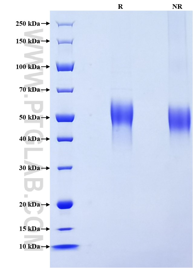 Purity of Recombinant Human IL-2 R gamma was determined by SDS-PAGE. The protein was resolved in an SDS-PAGE in reducing (R) and non-reducing (NR) conditions and stained using Coomassie blue.