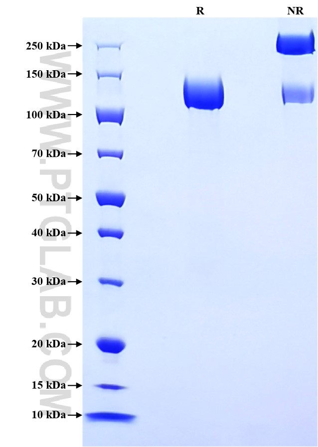 Purity of Recombinant Mouse TLR3 was determined by SDS-PAGE. The protein was resolved in an SDS-PAGE in reducing (R) and non-reducing (NR) conditions and stained using Coomassie blue.