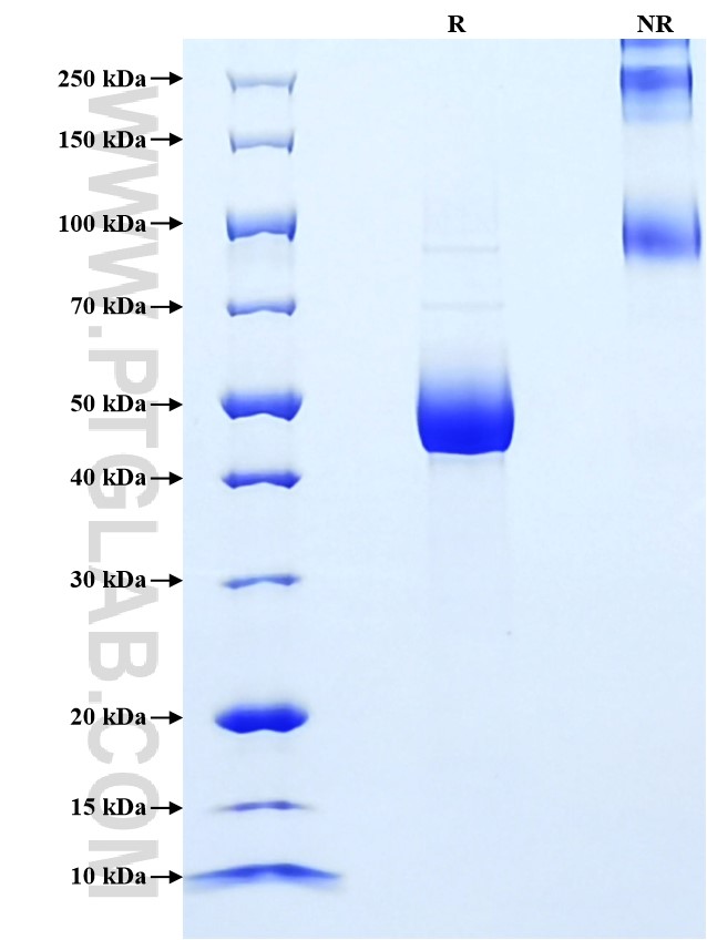 Purity of Recombinant Human IL-31 was determined by SDS-PAGE. The protein was resolved in an SDS-PAGE in reducing (R) and non-reducing (NR) conditions and stained using Coomassie blue.