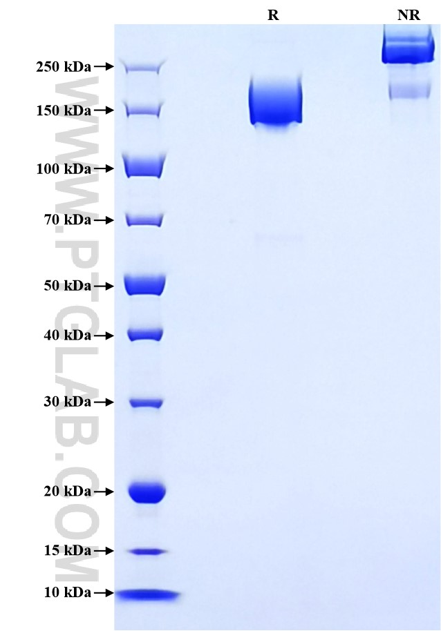 Purity of Recombinant Human ACE was determined by SDS-PAGE. The protein was resolved in an SDS-PAGE in reducing (R) and non-reducing (NR) conditions and stained using Coomassie blue.