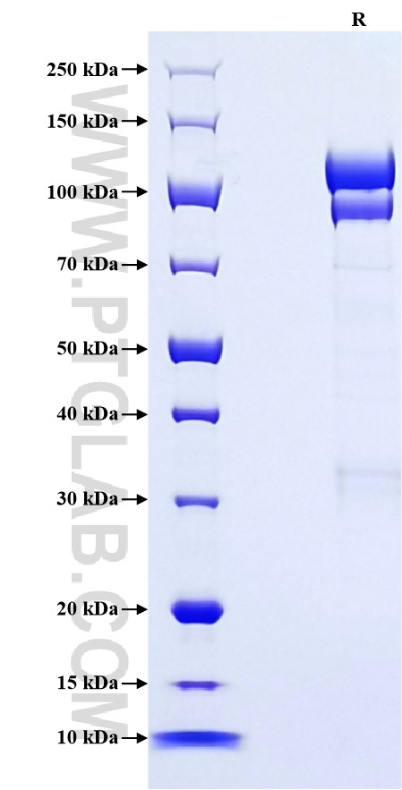 Purity of Recombinant Human Complement C2 was determined by SDS-PAGE. The protein was resolved in an SDS-PAGE in reducing (R) condition and stained using Coomassie blue.