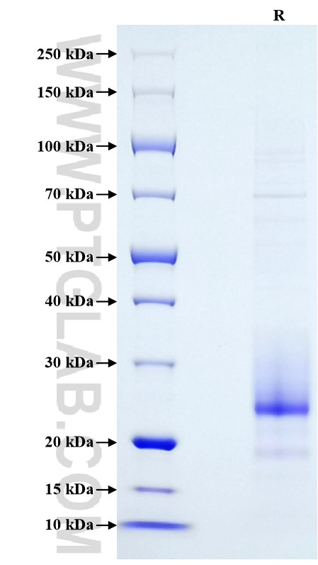 Purity of Recombinant Human IL22 was determined by SDS-PAGE. The protein was resolved in an SDS-PAGE in reducing (R) conditions and stained using Coomassie blue.